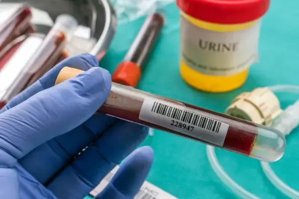 Bloedbuisje, potje urine voor onderzoek